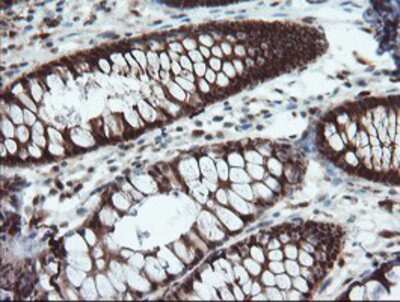 Immunohistochemistry-Paraffin: ASC/TMS1 Antibody (OTI3E9) [NBP2-03818]