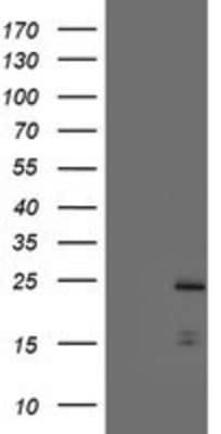 Western Blot: ASC/TMS1 Antibody (OTI3E9) [NBP2-03818]