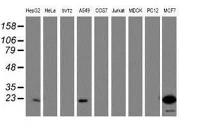 Western Blot: ASC/TMS1 Antibody (OTI3E9) [NBP2-03818]