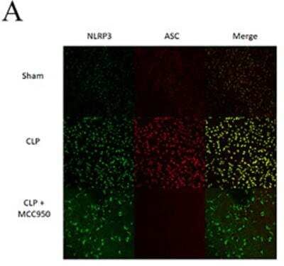 Immunocytochemistry/ Immunofluorescence: ASC/TMS1 Antibody - BSA Free [NBP1-78977]