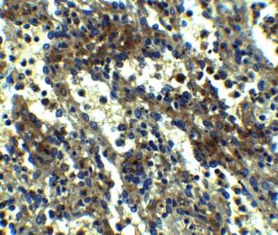 Immunohistochemistry: ASC/TMS1 Antibody - BSA Free [NBP1-77297]