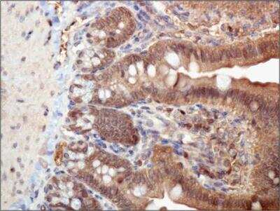 Immunohistochemistry: ASC/TMS1 Antibody - BSA Free [NBP1-78977]