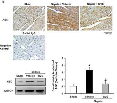 Immunohistochemistry: ASC/TMS1 Antibody - BSA Free [NBP1-78977]