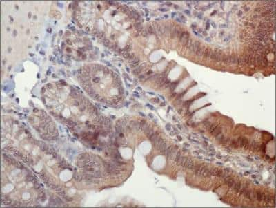 Immunohistochemistry: ASC/TMS1 Antibody - BSA Free [NBP1-78978]