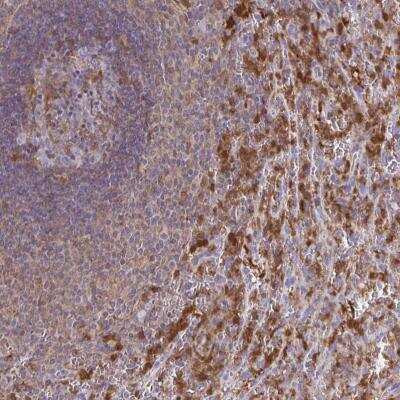 Immunohistochemistry-Paraffin: ASC/TMS1 Antibody [NBP2-48925]