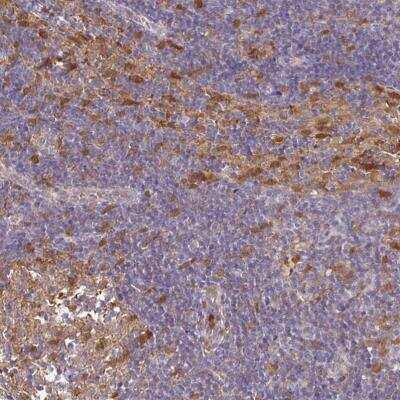 Immunohistochemistry-Paraffin: ASC/TMS1 Antibody [NBP2-48925]