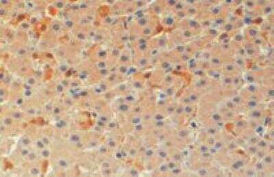 Immunohistochemistry-Paraffin: ASC/TMS1 Antibody [NB100-870]
