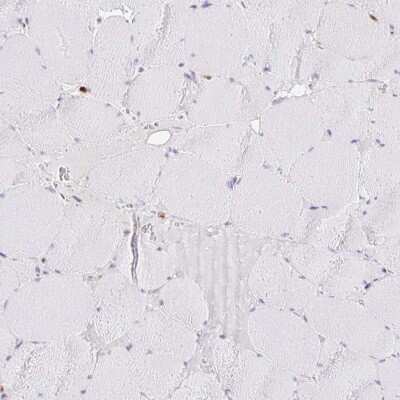 Immunohistochemistry-Paraffin: ASC/TMS1 Antibody [NBP2-48925]