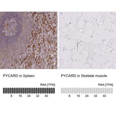 Immunohistochemistry-Paraffin: ASC/TMS1 Antibody [NBP2-48925]