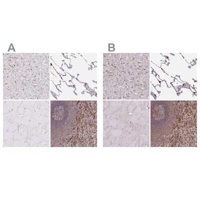 Immunohistochemistry-Paraffin: ASC/TMS1 Antibody [NBP2-48925]