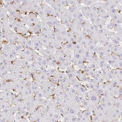 Immunohistochemistry-Paraffin: ASC/TMS1 Antibody [NBP2-48925]