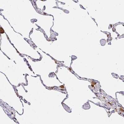 Immunohistochemistry-Paraffin: ASC/TMS1 Antibody [NBP2-48925]