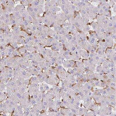 Immunohistochemistry-Paraffin: ASC/TMS1 Antibody [NBP2-49133]