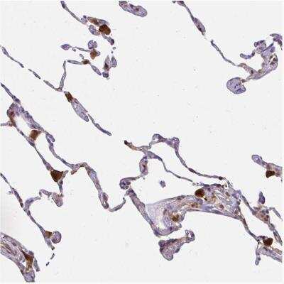 Immunohistochemistry-Paraffin: ASC/TMS1 Antibody [NBP2-49133]