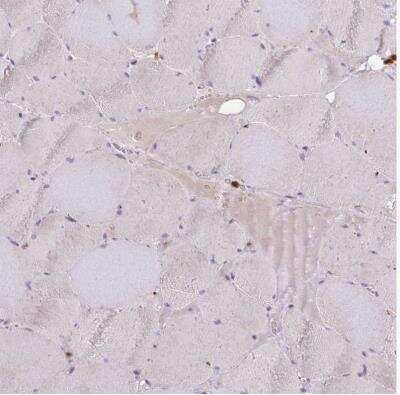 Immunohistochemistry-Paraffin: ASC/TMS1 Antibody [NBP2-49133]