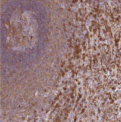 Immunohistochemistry-Paraffin: ASC/TMS1 Antibody [NBP2-49133]