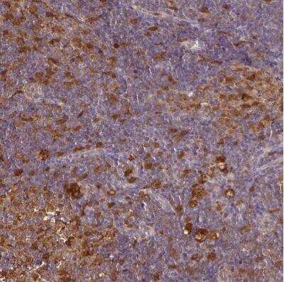 Immunohistochemistry-Paraffin: ASC/TMS1 Antibody [NBP2-49133]