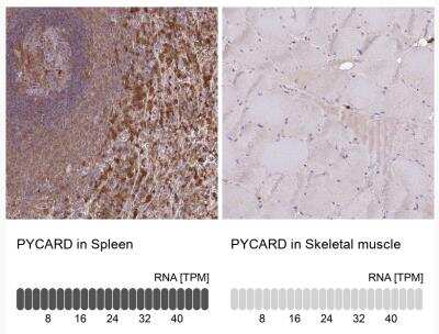 Immunohistochemistry-Paraffin: ASC/TMS1 Antibody [NBP2-49133]