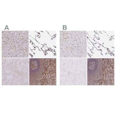 Immunohistochemistry-Paraffin: ASC/TMS1 Antibody [NBP2-49133]