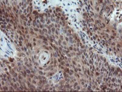 Immunohistochemistry: ASC/TMS1 Antibody (OTI3E9) - Azide and BSA Free [NBP2-71853]