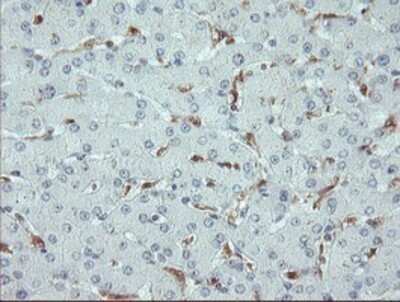 Immunohistochemistry: ASC/TMS1 Antibody (OTI3E9) - Azide and BSA Free [NBP2-71853]