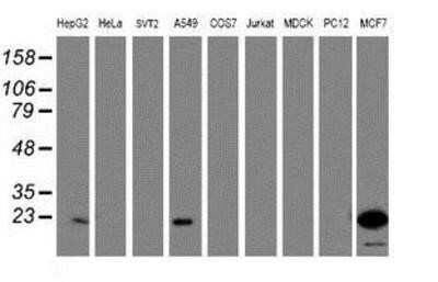 Western Blot: ASC/TMS1 Antibody (OTI3E9)Azide and BSA Free [NBP2-71853]