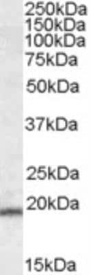 Western Blot: ASC/TMS1 Antibody [NB100-870]