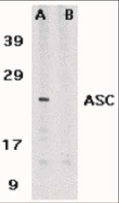 Western Blot: ASC/TMS1 AntibodyBSA Free [NBP1-77297]