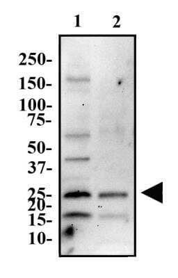 Western Blot: ASC/TMS1 AntibodyBSA Free [NBP1-78977]