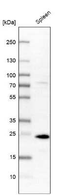 Western Blot: ASC/TMS1 Antibody [NBP2-48925]