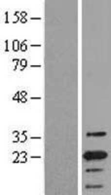 Western Blot: ASC/TMS1 Overexpression Lysate [NBL1-15016]