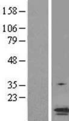 Western Blot: ASC/TMS1 Overexpression Lysate [NBL1-15017]