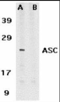 Western Blot: ASC/TMS1 Antibody Blocking Peptide [NBP1-77297PEP]