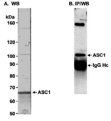 Western Blot: ASC1 Antibody [NB100-419]