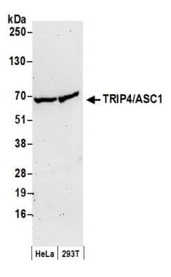 Western Blot: ASC1 Antibody [NB100-419]