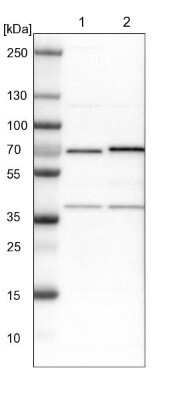 Western Blot: ASC1 Antibody [NBP1-89656]