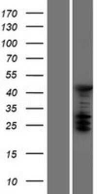 Western Blot: ASC1 Overexpression Lysate [NBP2-07073]