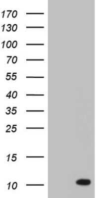 Western Blot: ASC2 Antibody (OTI9C10) [NBP2-45495]