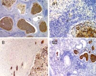 Immunohistochemistry: ASC2 Antibody [NB100-56076]
