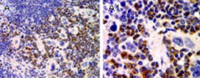 Immunohistochemistry-Paraffin: ASC2 Antibody [NB100-56076]
