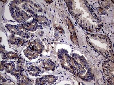 Immunohistochemistry: ASC2 Antibody (OTI9C10) - Azide and BSA Free [NBP2-72480]