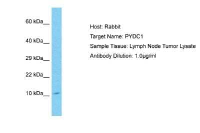 Western Blot: ASC2 Antibody [NBP2-86581]