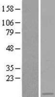 Western Blot: ASC2 Overexpression Lysate [NBL1-15020]