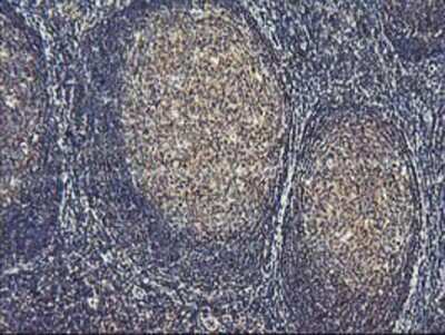 Immunohistochemistry-Paraffin: ASCC1 Antibody (OTI6G5) [NBP2-01345]