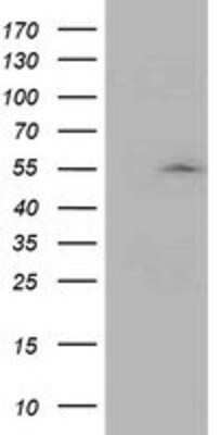 Western Blot: ASCC1 Antibody (OTI6G5) [NBP2-01345]