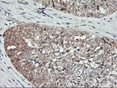 Immunohistochemistry: ASCC1 Antibody (OTI6G5) - Azide and BSA Free [NBP2-71879]