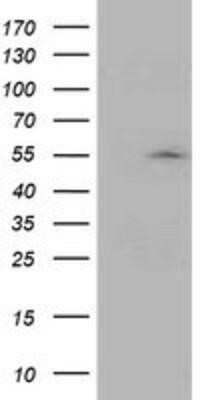 Western Blot: ASCC1 Antibody (OTI6G5)Azide and BSA Free [NBP2-71879]