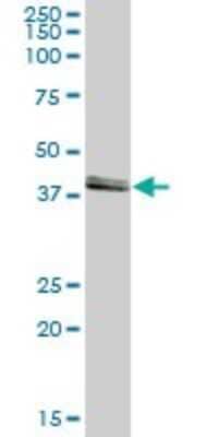 Western Blot: ASCC1 Antibody [H00051008-B01P]