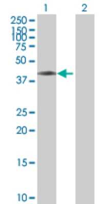 Western Blot: ASCC1 Antibody [H00051008-B01P]