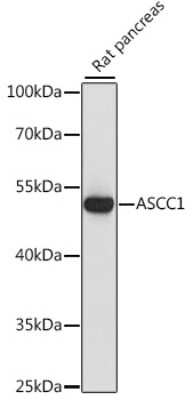 Western Blot: ASCC1 AntibodyAzide and BSA Free [NBP2-92631]